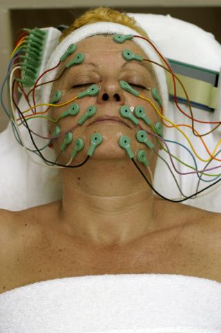 image Electrolifting: finalización de la colocación de electrodos