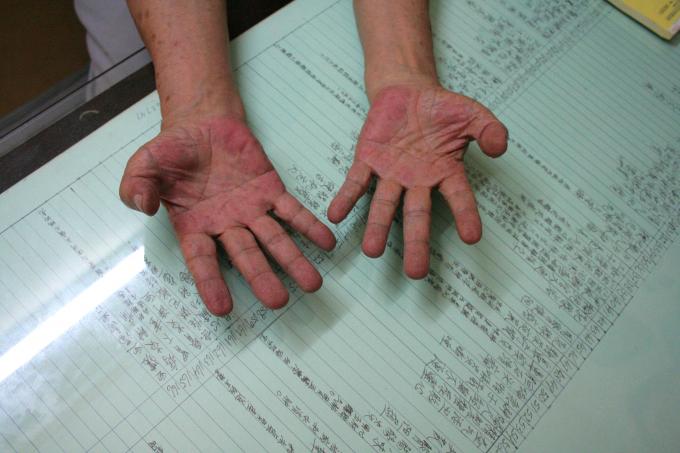 image Medicina china, Jakarta, Indonesia