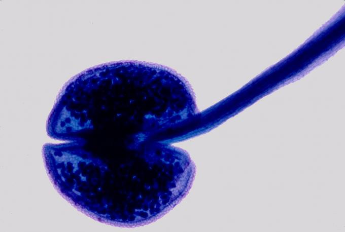 image Estambre de Prunus