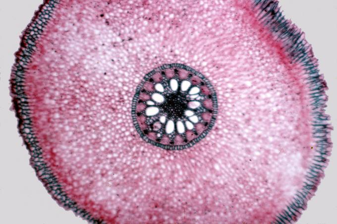 image Corte de raíz