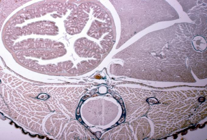 image Corte de tubo digestivo