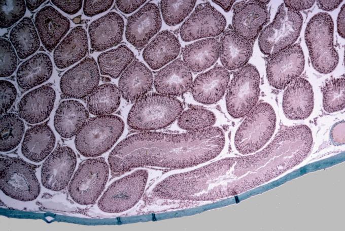 image Corte de testículo