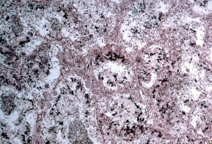 image Testiculo de rana