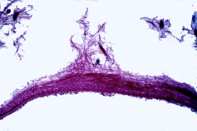 image Talo de un líquen