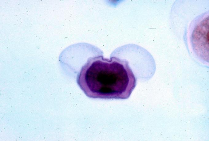 image Grano de polen