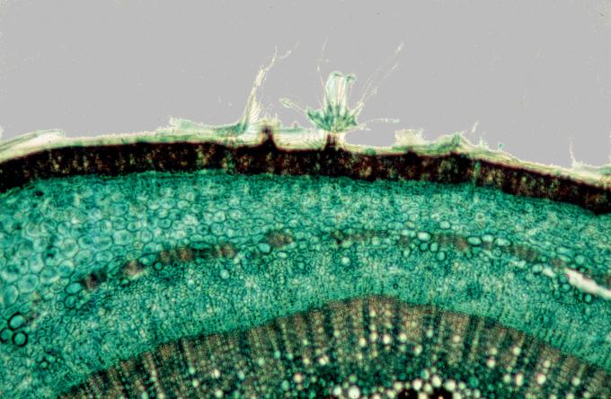 image Pelos radicales de absorción