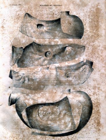 image Enfermedades del estómago