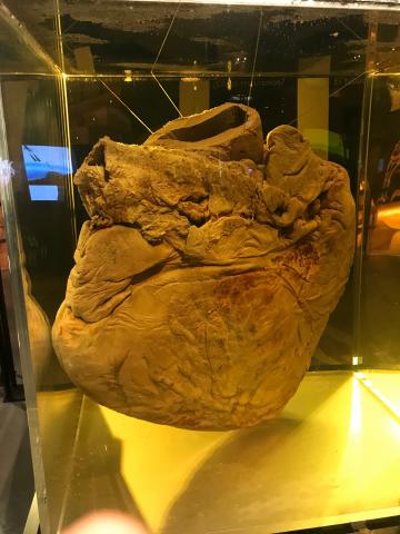 image Corazón de ballena