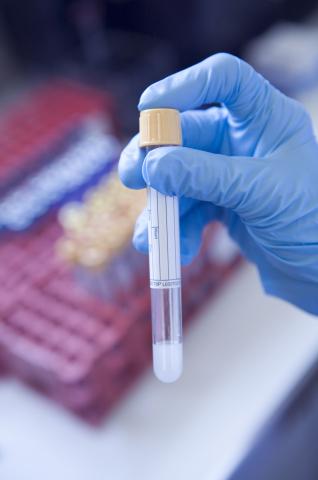 image Tubo de muestras en el laboratorio de un hospital