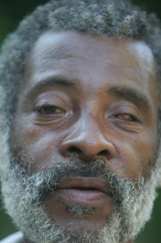 image Hombre con catarata en los ojos, Quilombo, Sao Paulo, Brasil