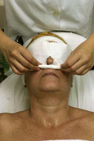 image Electrolifting: retirada de tissue