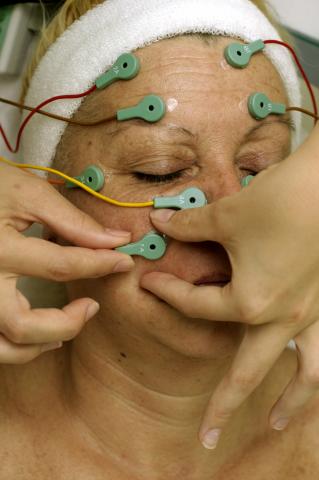 image Electrolifting: retirada de electrodos