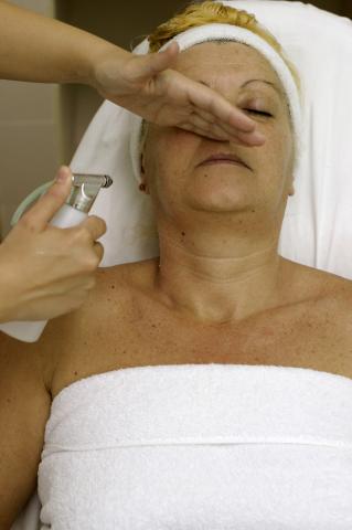 image Electrolifting: pulverización fusiforme