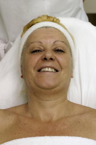 image Electrolifting: base hidratante extendida y finalización del proceso