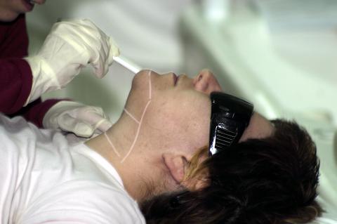 image Fotodepilación: marcación de zona a tratar