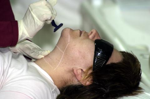 image Fotodepilación: rasurado