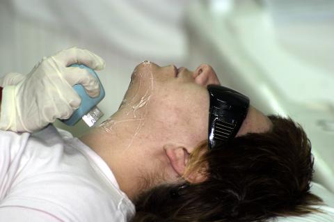 image Fotodepilacion: colocación del electrodo en zona