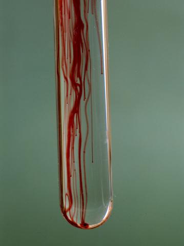 image Disolución de anilina