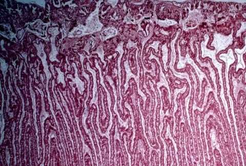 image Tejido epitelial humano