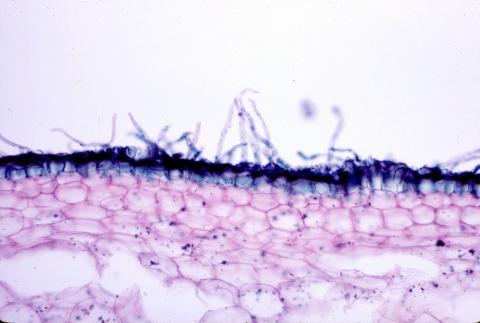 image Pelos radicales