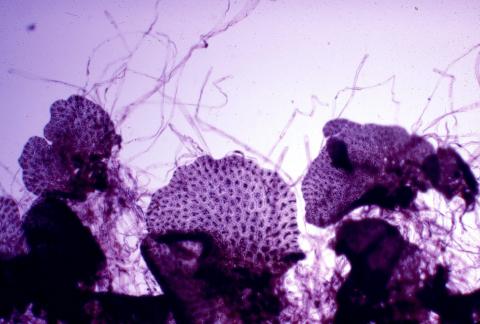 image Protalo de un helecho