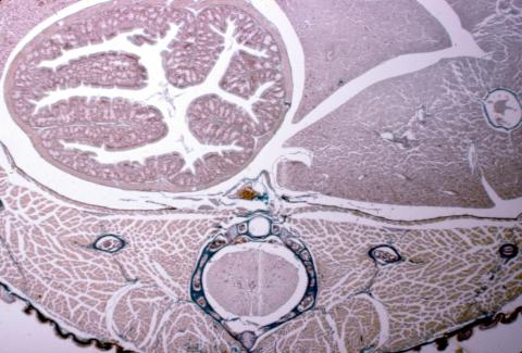 image Corte de tubo digestivo