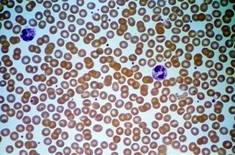 image Frotis de sangre