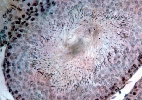 image Corte de testículo