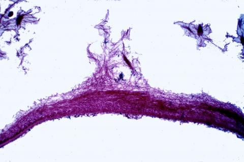 image Talo de un líquen