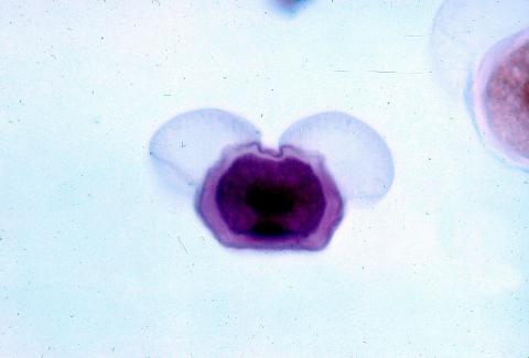 image Grano de polen