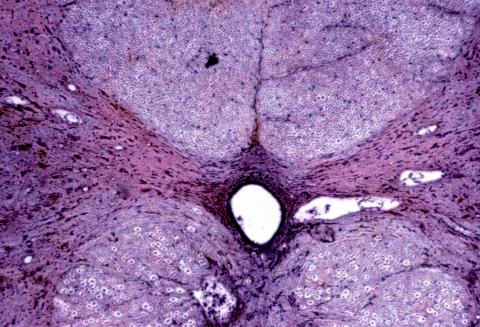 image Corte de médula