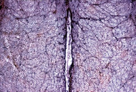 image Corte de médula