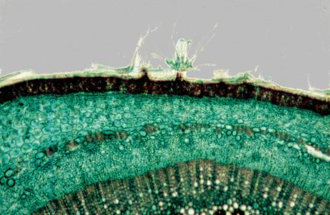 image Pelos radicales de absorción