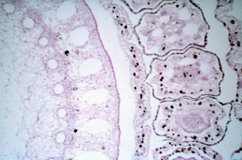 image Tallo de Pteridofita