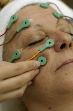 image Electrolifing: colocación de los electrodos