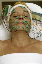 image Electrolifting: finalización de la colocación de electrodos