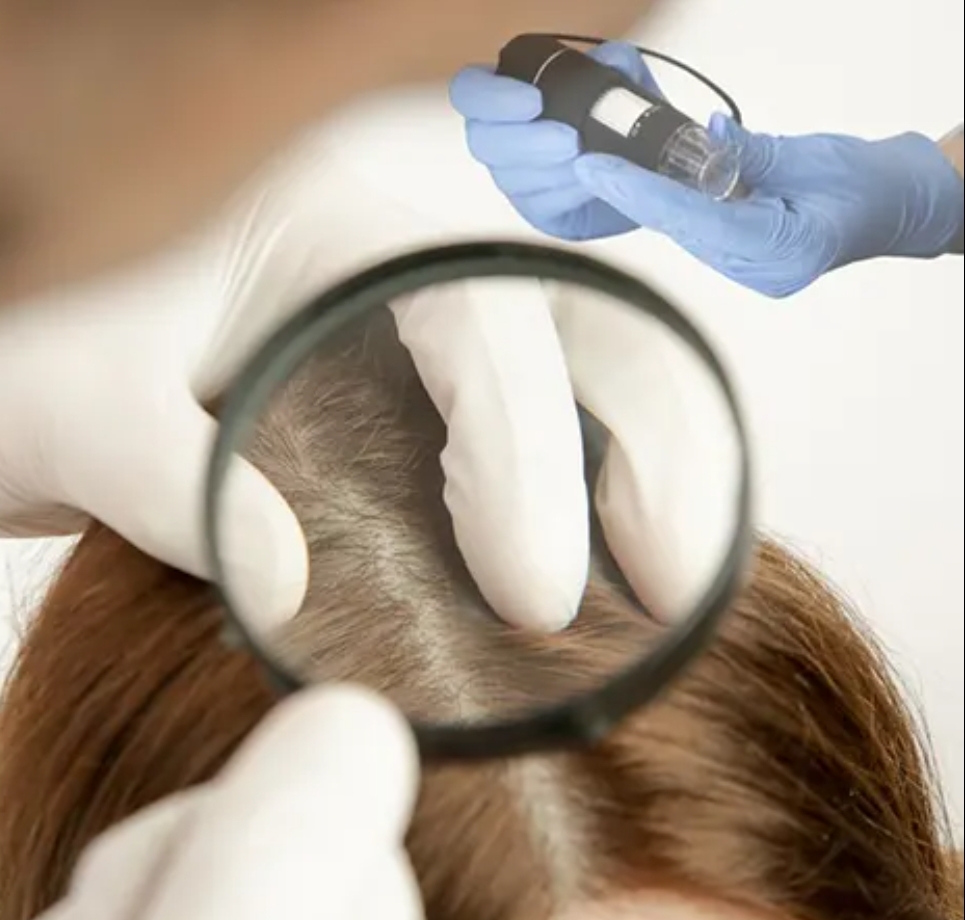 Diagnóstico visual de alteraciones capilares