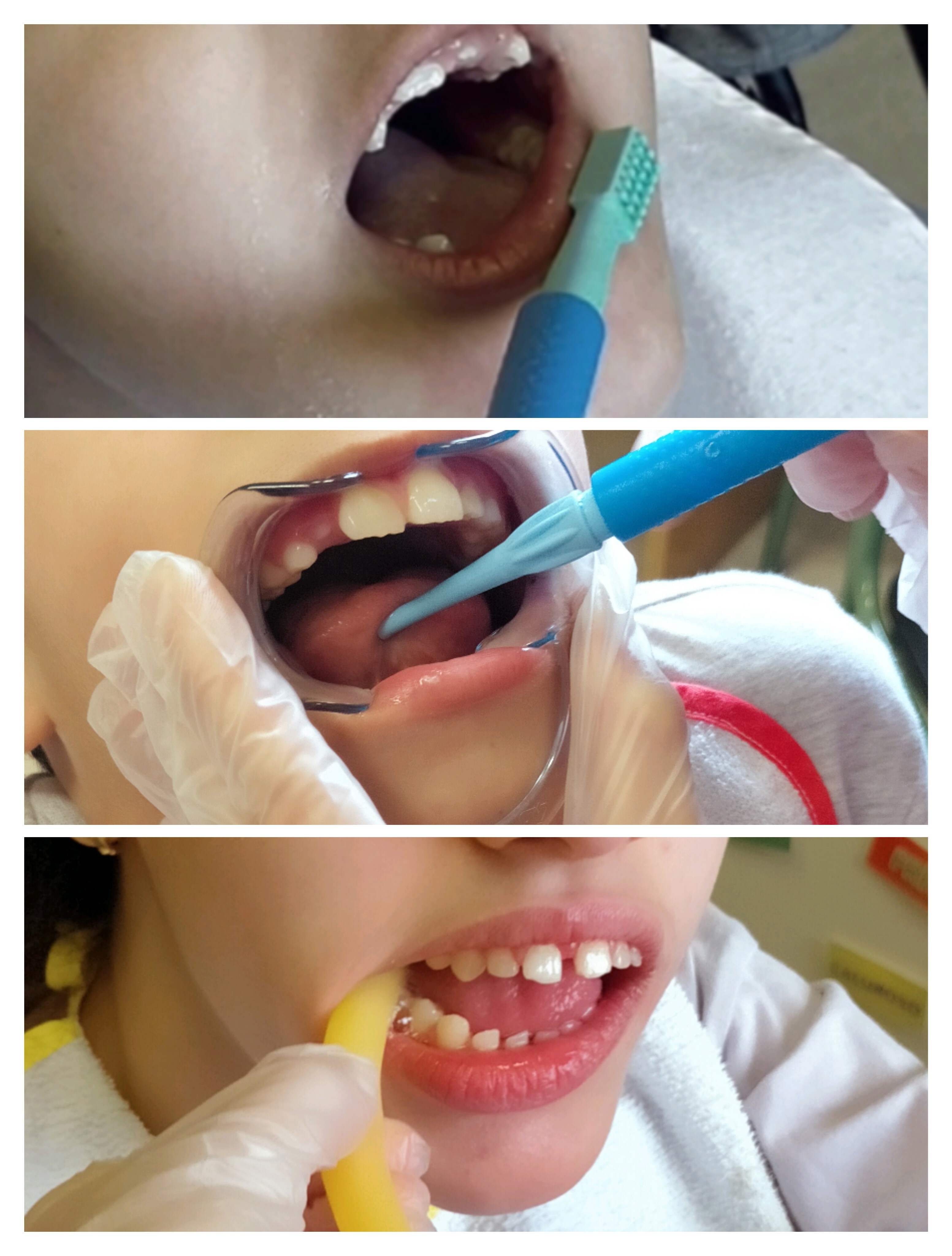 TERAPIA MIOFUNCIONAL