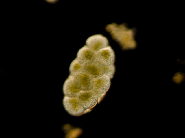 image Saco ovígero de copépodo ciclopoide (Cyclops sp.) 