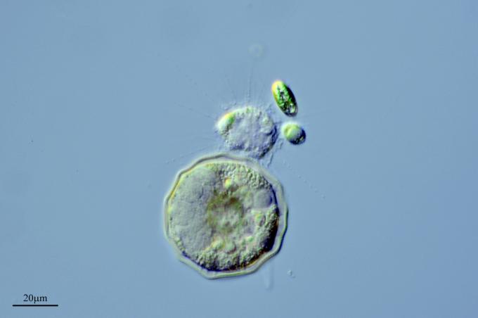 image Amebas (Arcella sp. y Raphidiophrys sp.) y algas (Chlamydomonas sp. y Mallomonas sp.), Ortigosa de Cameros, La Rioja 