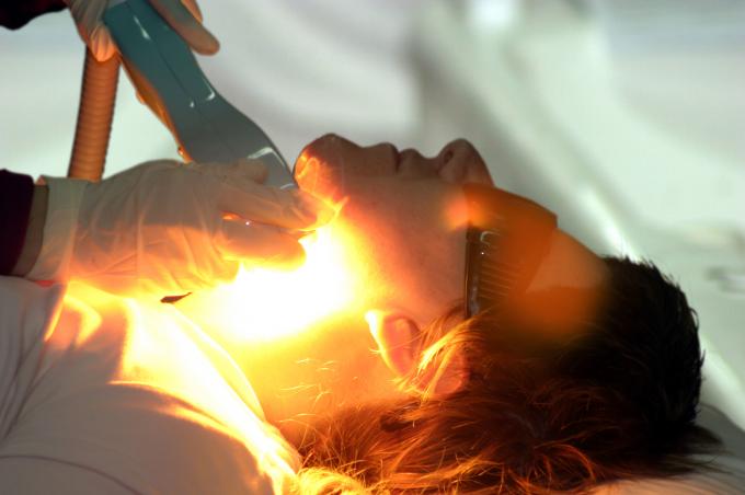 image Fotodepilación: disparo luminoso