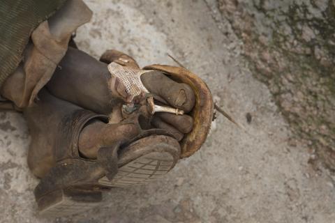 image Pies de un mendigo de Harar, Etiopía