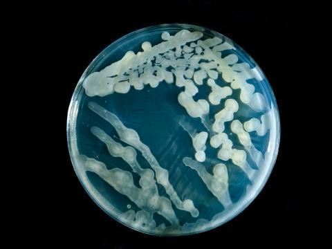 image Cultivo de bacteria Bacillus cereus en placa de Petri