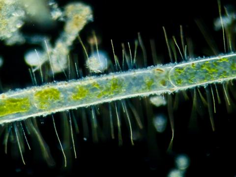 image Alga filamentosa (Spirogyra sp.) atacada por bacterias filamentosas