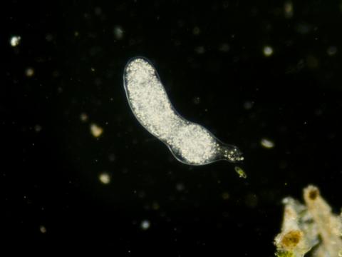 image Ameba (Trichamoeba sp.)