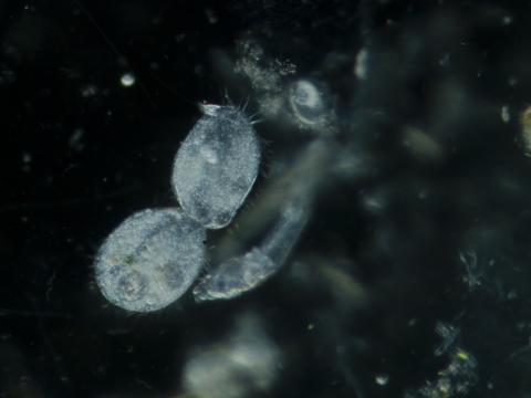 image Ciliado (Oxytricha sp.) - Proceso de división celular o bipartición 5