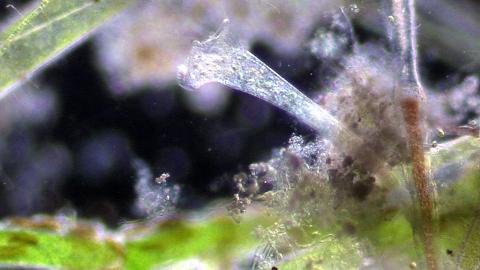 image Ciliado (Stentor sp.)