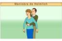 Maniobra de Heimlich
