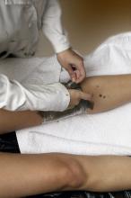 image Aplicación localizada de parafangos: retirada de parafango. Paso 2